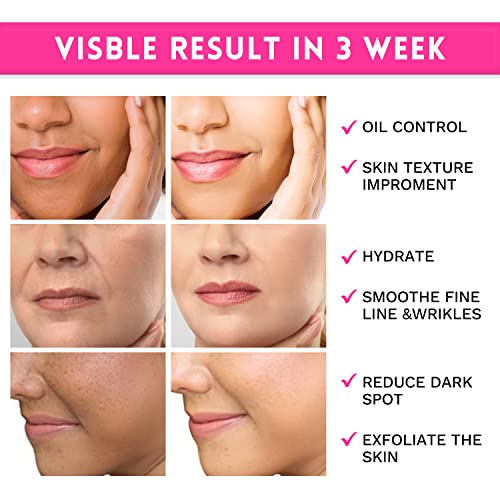ANAIRUI Glycolic Acid Pads, Resurfacing AHA Facial Pads