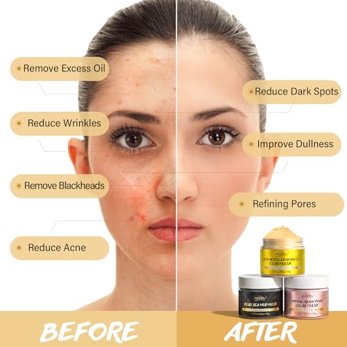 Mud Mask Set: Turmeric, Dead Sea, Himalayan