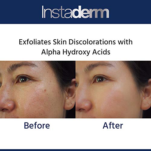Glycolic Acid Anti-Aging Mud Mask: Reduces & Smoothes