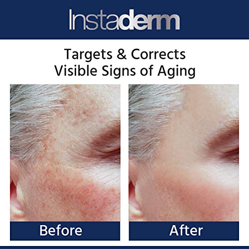Glycolic Acid Anti-Aging Mud Mask: Reduces & Smoothes