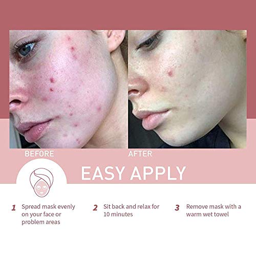 Natural Pink Clay Mask: Deep Cleansing, Hydrating & Brightening