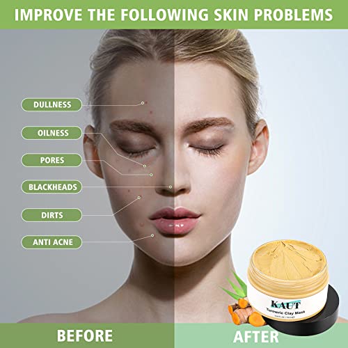 Organic Turmeric Mud Mask for Acne Control