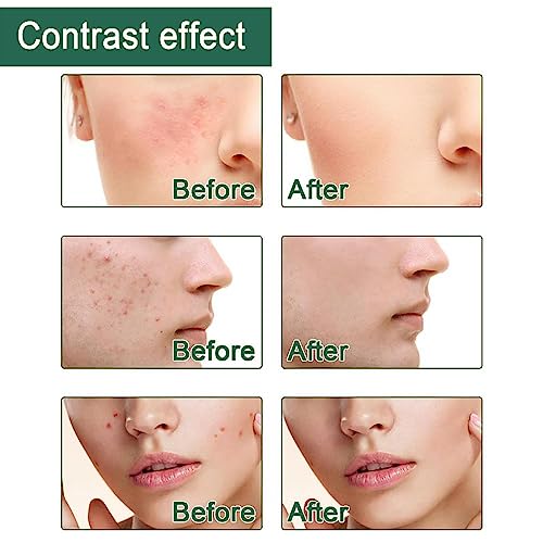 Tea Tree Mud Mask Set - Teen Girls' Skincare