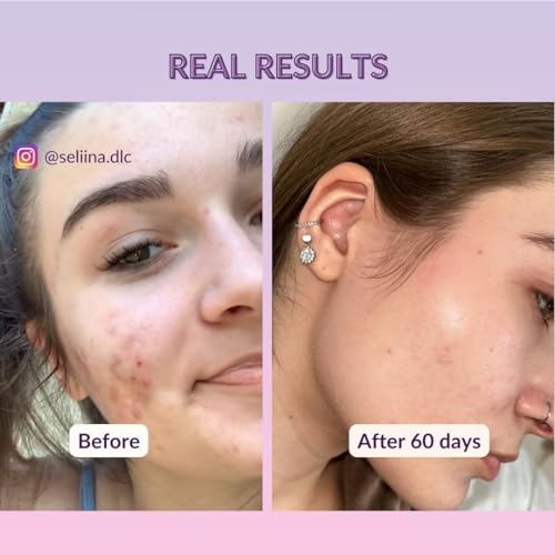 Dead Sea Mud Mask with White Clay - Vegan Cosmetics