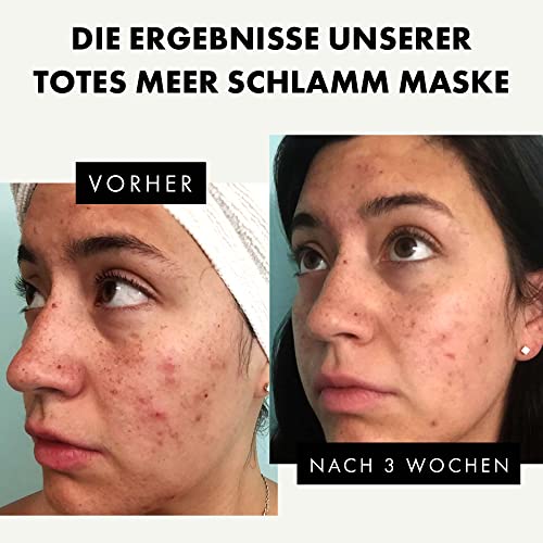 Organic DeadSea Mud Mask - Anti-Acne & Anti-Ageing