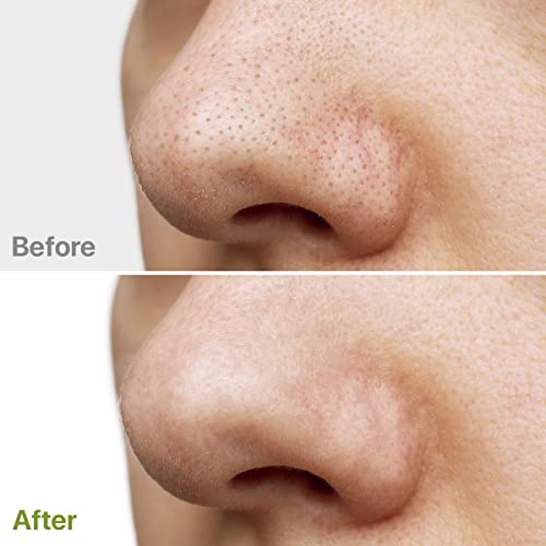 Glycolic Acid Resurfacing Facial Pads - 60 Pre-Moistened