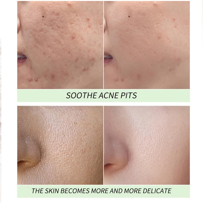 Salicylic Mud Mask for Pore Control and Cleansing