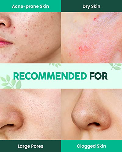 Matcha Tea Tree Clay Mask - Acne Treatment