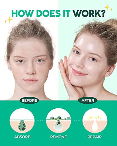 Matcha Tea Tree Clay Mask - Acne Treatment