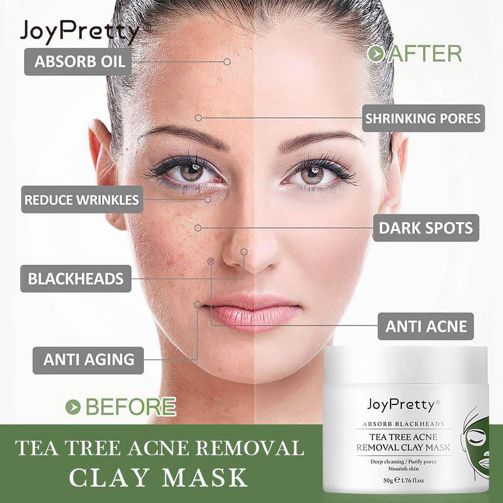Tea Tree Acne Removal Clay Mask