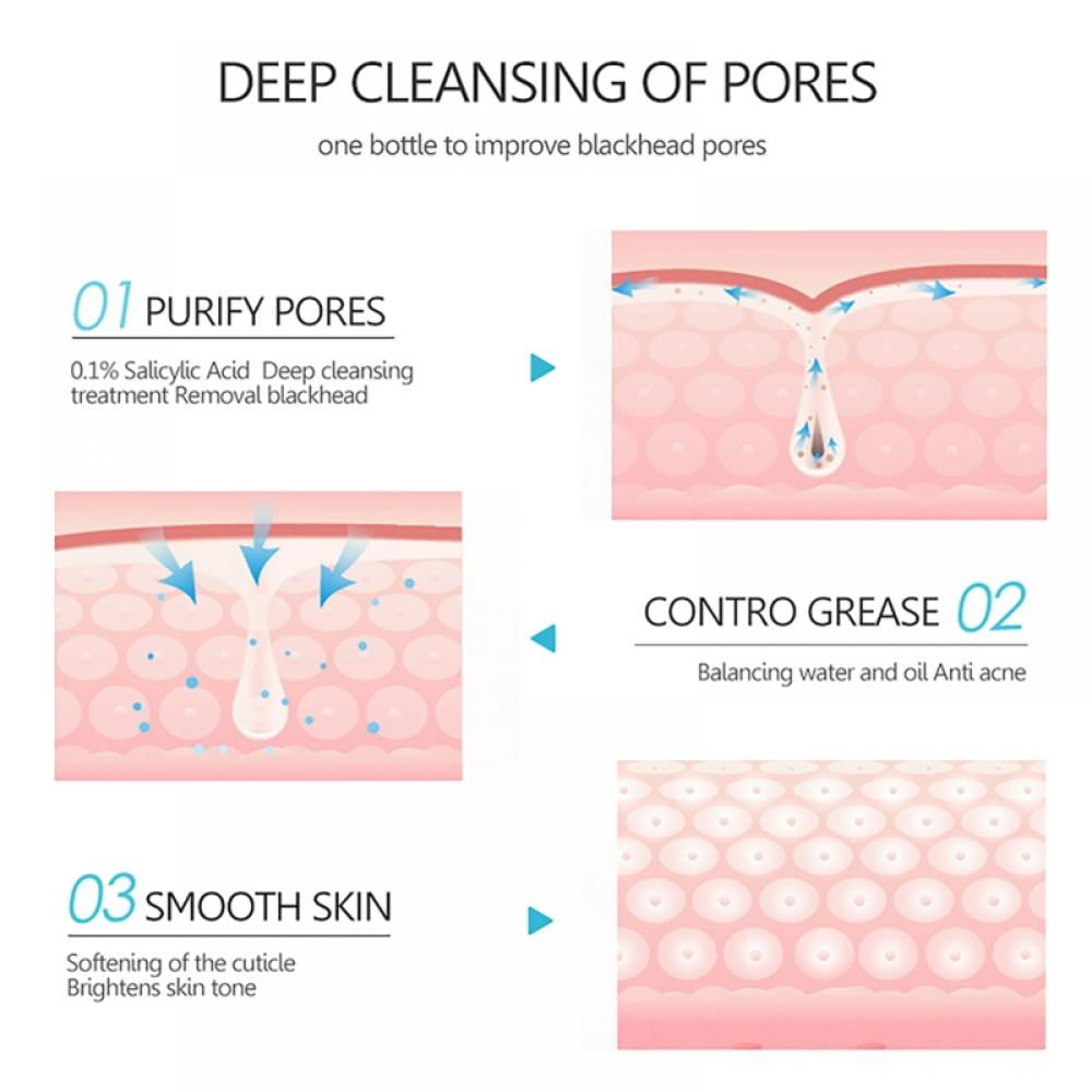 Salicylic Acid Mud Mask - Skincare for All