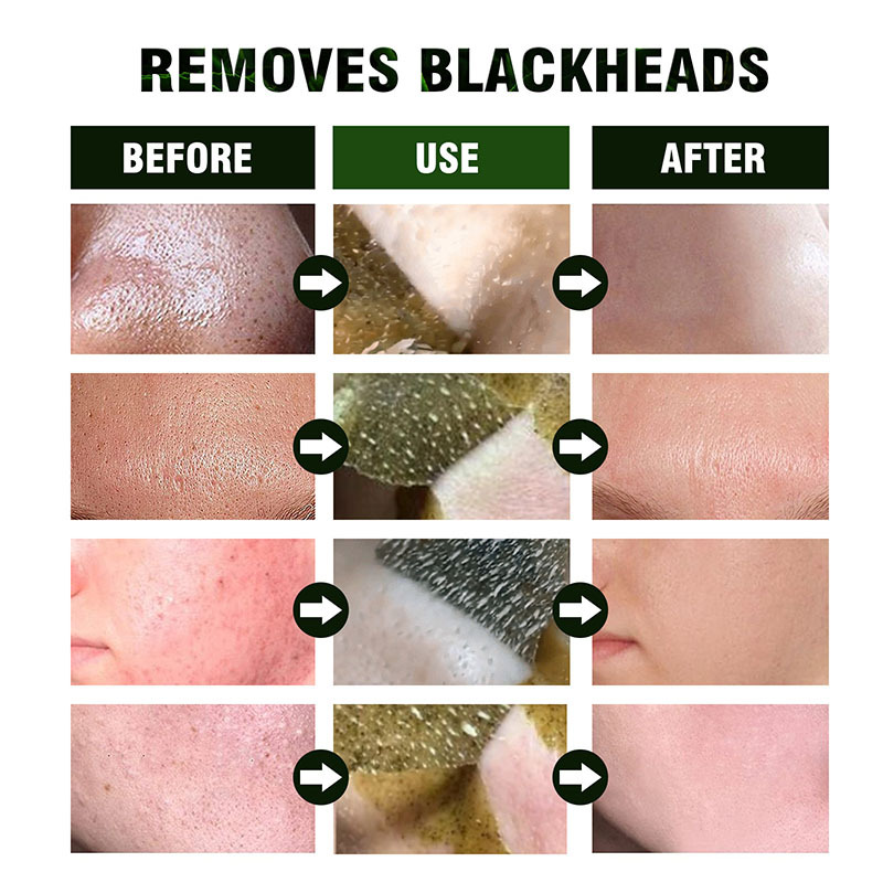 Green Tea Blackhead Remover Mud Mask 40g