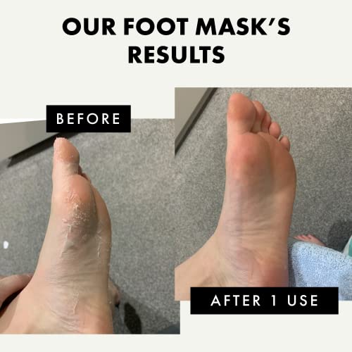 Softens Rough Feet - Exfoliating Foot Mask