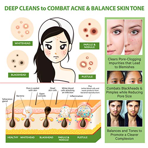 Organic Green Tea Mud Mask for Acne