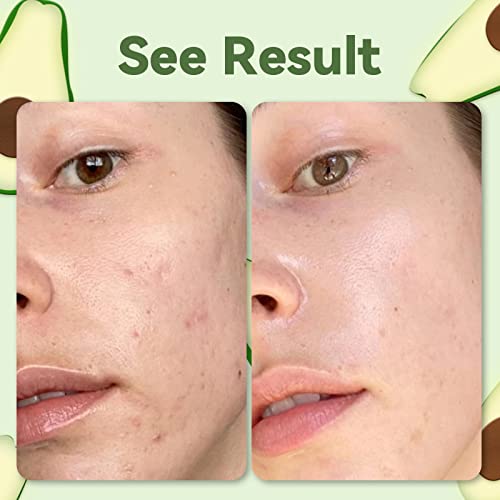 Green Tea Avocado Matcha Clay Mask - 120g