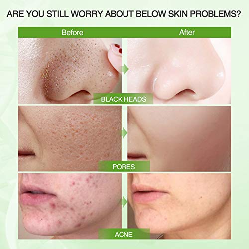 Organic Mud Mask Collection