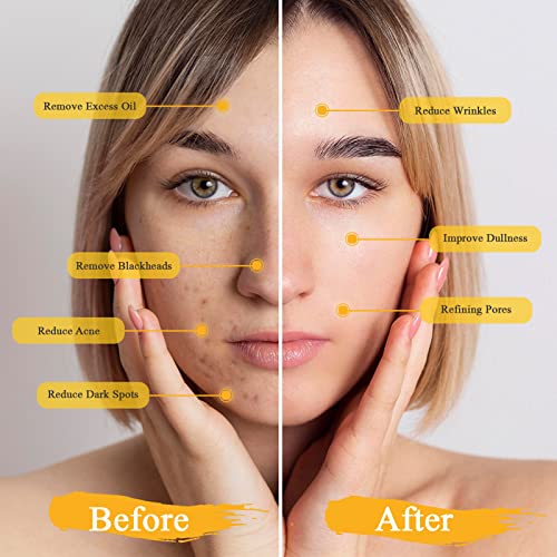 Mud Mask Set for Deep Cleansing and Skincare