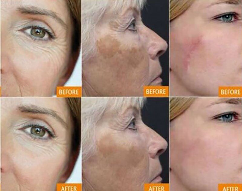 Anti-Aging Skin Detox Mud Mask