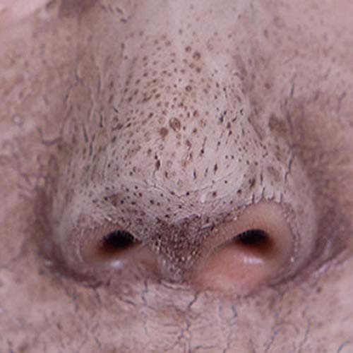 Dead Sea Mud Mask for Cleansing & Pore Refining