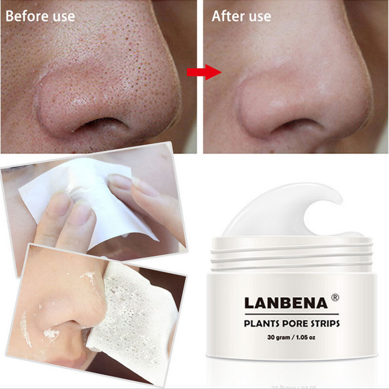 LANBENA Blackhead Remover Facial Pore Strips