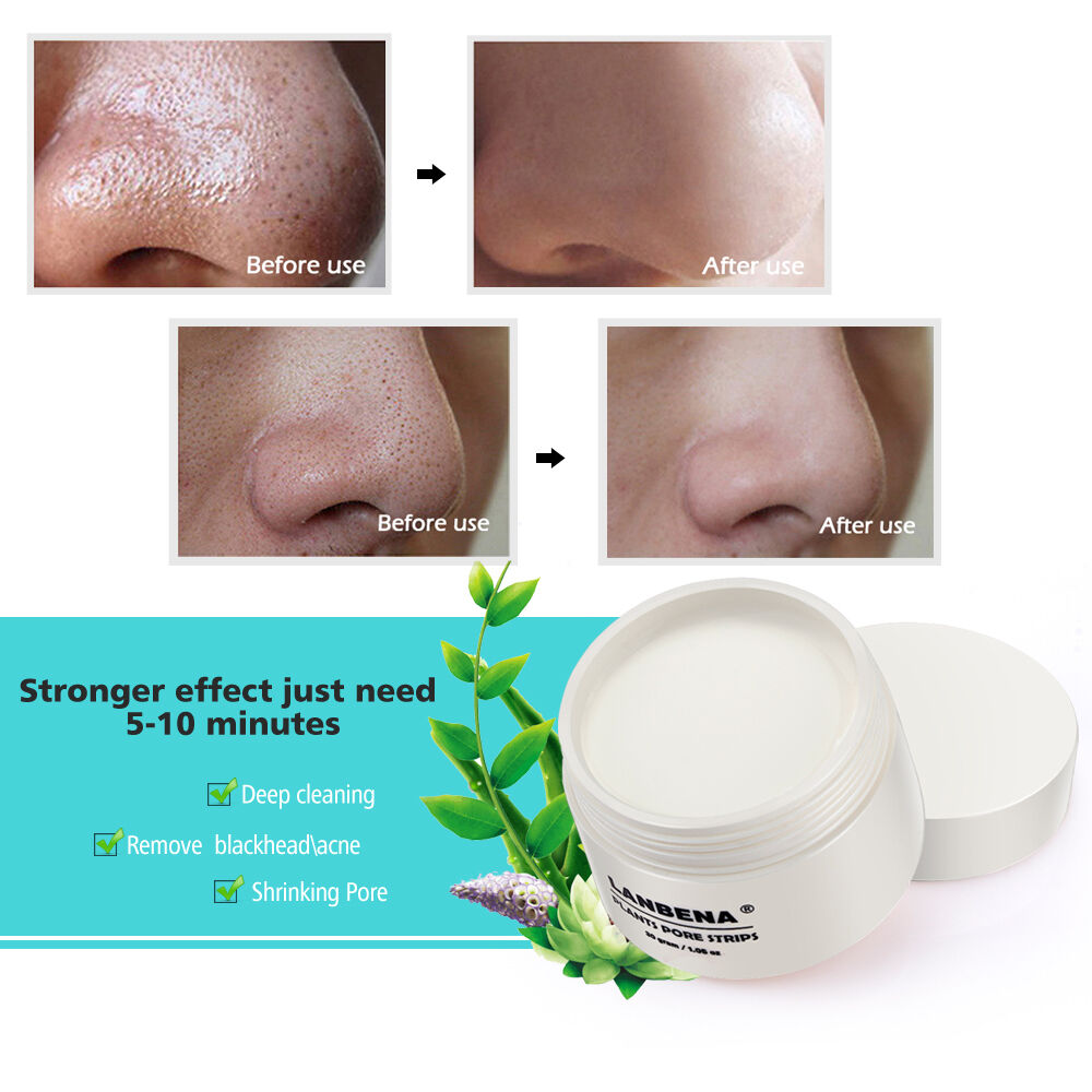 LANBENA Blackhead Remover Facial Pore Strips