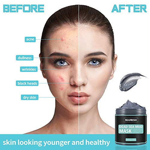 Dead Sea Mud Mask Set for Detoxifying Skin