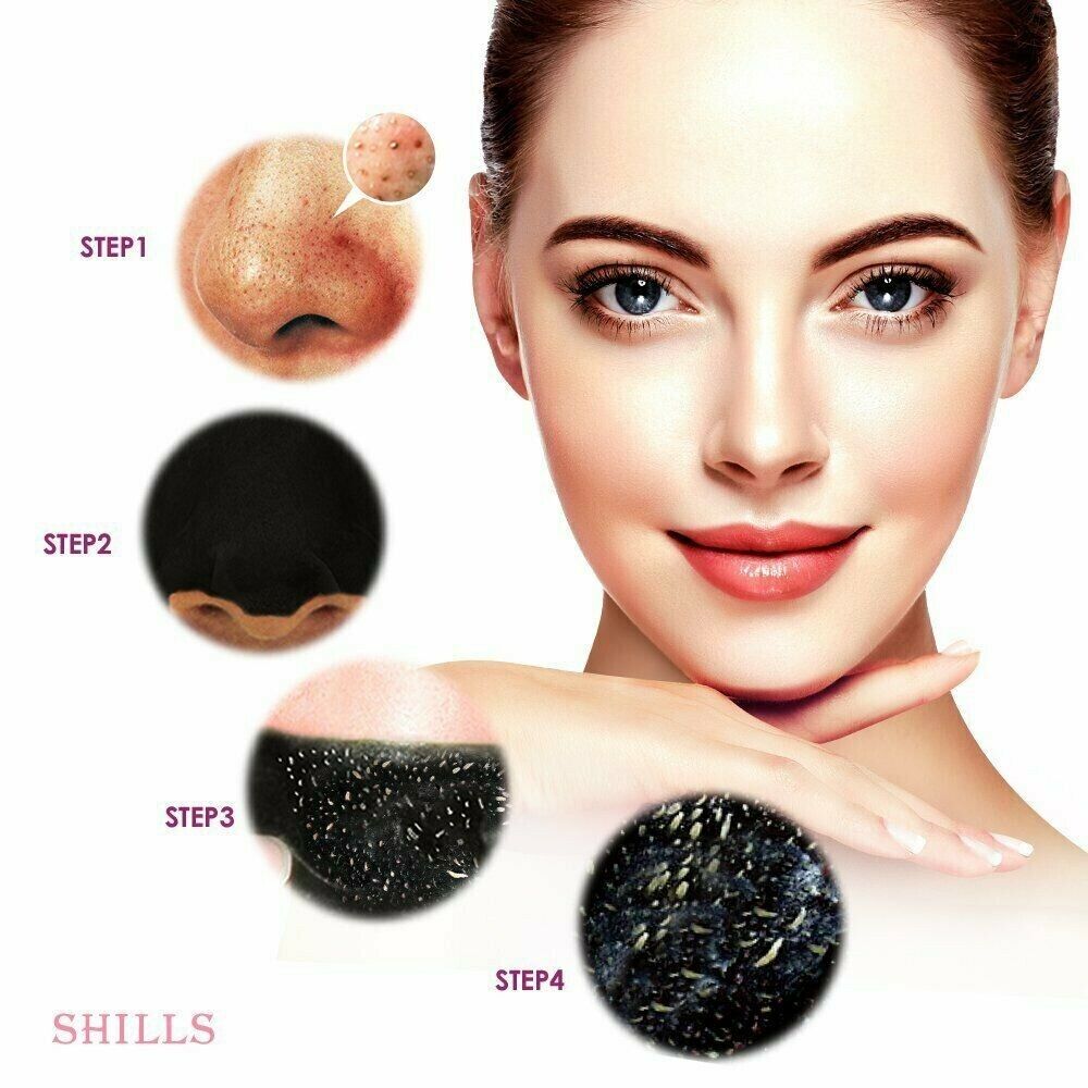 Charcoal Blackhead Remover Mask - Purifying & Acne Fighting