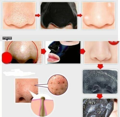 Charcoal Blackhead Remover Mask - Purifying & Acne Fighting