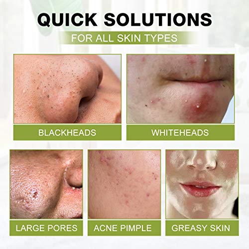 3-in-1 Charcoal Blackhead Remover with Tea Tree