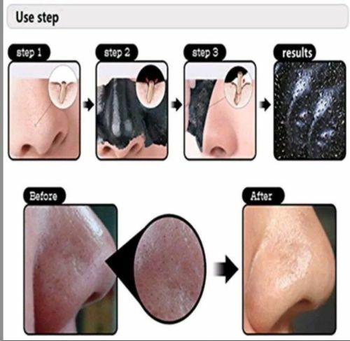 Blackhead Remover Mud Mask - UK