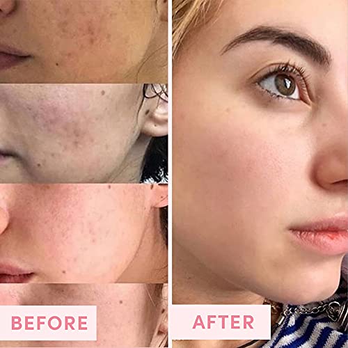 Australian Pink Clay Mask for Pores & Pigmentation
