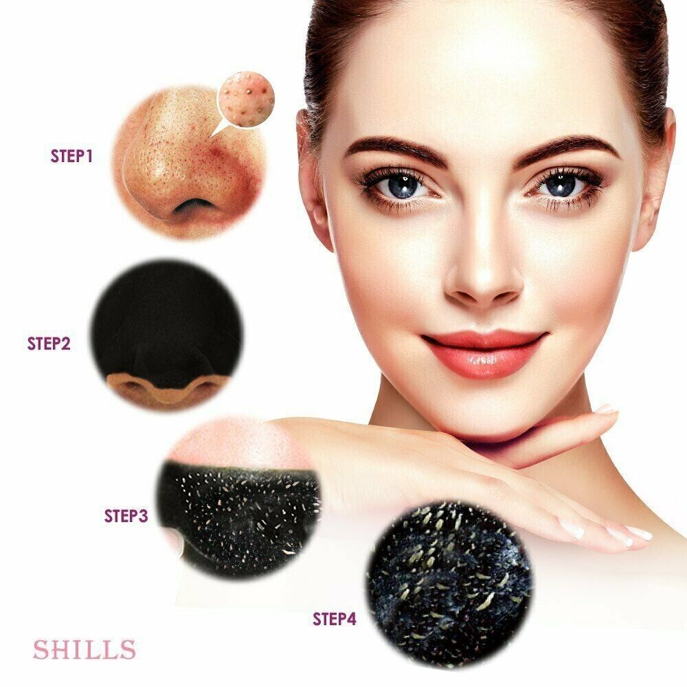 Acne Purifying Charcoal Mask