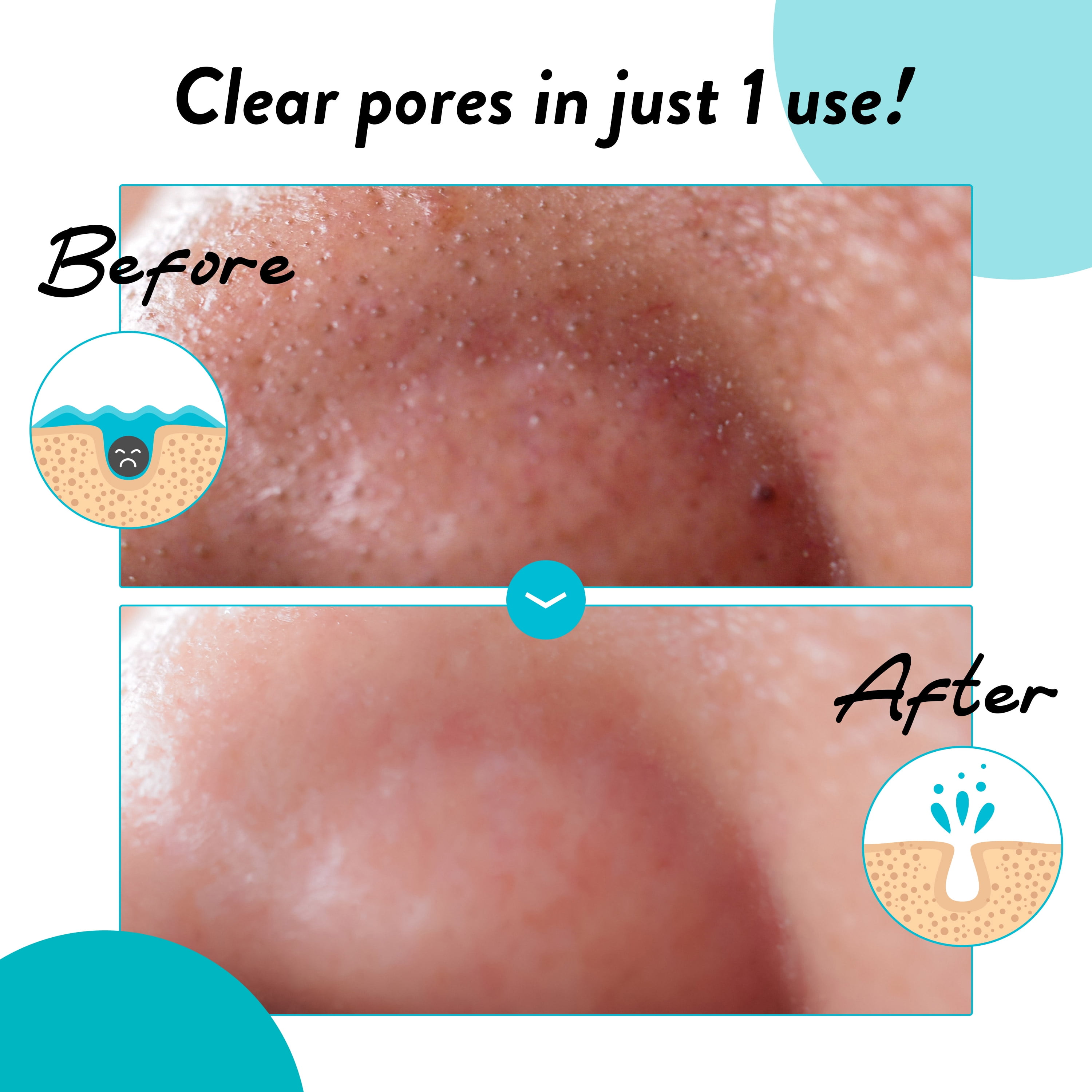 Charcoal Peel Off Mask - 2.8oz