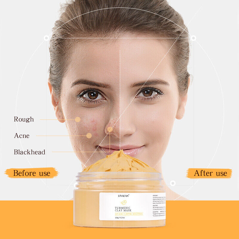 Acne Control Turmeric Clay Mask