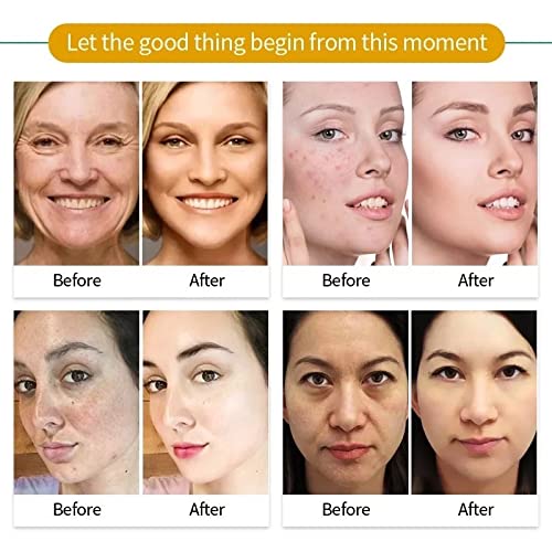 Bentonite Mud Mask with Aloe & Turmeric