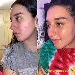 Charcoal Tea Tree Mud Mask for Clear Skin