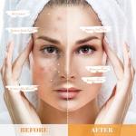 Turmeric Clay Mask for Clear, Radiant Skin