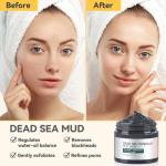 3-Pack Clay Masks for Detox and Acne Control