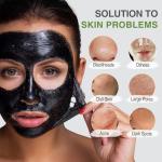 Activated Charcoal Blackhead Removal Face Mask