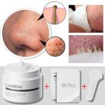 LANBENA Blackhead Mask and Pore Strips Bundle