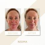 Kedma Dead Sea Black Mud Mask - 100g