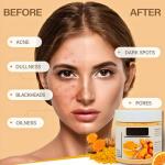 Turmeric Clay Mask for Dark Spots and Acne