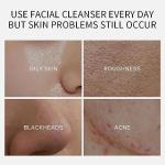 20 PCS Deep Cleanse Clay Mask Set