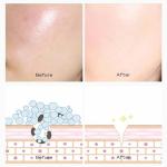 20 PCS Deep Cleanse Clay Mask Set