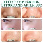 20 PCS Green Tea Clay Face Masks for All Skin Types