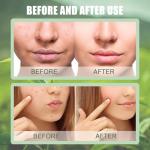 VEROA 21-Set Natural Clay Face Masks