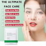 Acne Treatment Mud Mask Set - 6pcs