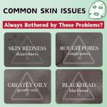 Acne Treatment Mud Mask Set - 6pcs