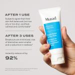 Murad Sulfur Clay Mask for Blemish Control