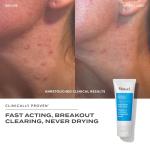 Murad Sulfur Clay Mask for Blemish Control